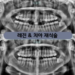 마포구청치과
